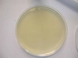 Difference Between Nutrient Agar (NA) and Plate Count Agar (PCA)