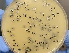 Baird-Parker Agar: Key Applications and Fundamental Principles in Bacteriological Research