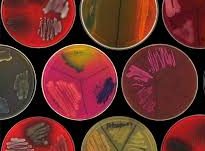 Understanding Microbial Strain Degradation and How to Prevent It