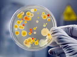 How to Identify Contaminants in Microbial Cultures