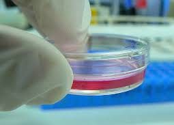 Differences Between Primary Cell Culture and Subculture