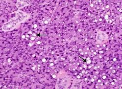 Causes of Cytoplasmic Vacuoles in Cell Culture and Solutions