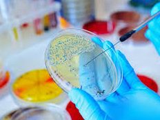 Internal Quality Control of Aseptic Rooms in Food Microbiology Labs