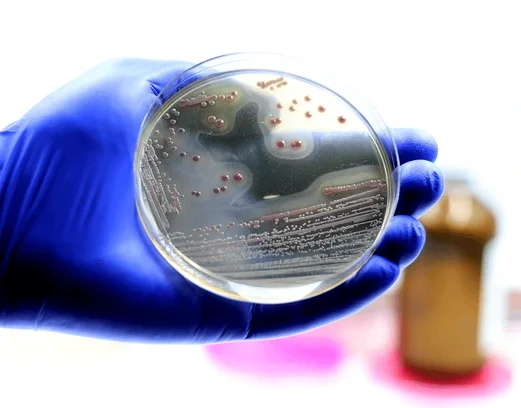 Chromogenic Culture Media: Decoding the “Secret Language” of Microorganisms with Color