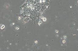 Preventing and Handling Black Dots in Cell Culture