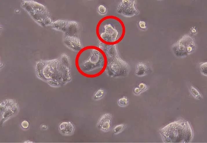 Causes and Solutions for Cell Vacuolization